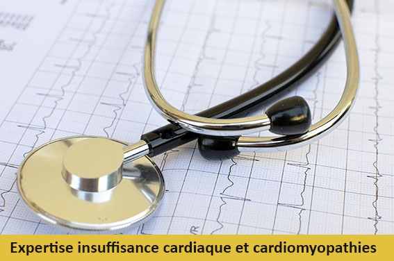 Illustration DIU Expertise en insuffisance cardiaque et cardiomyopathies