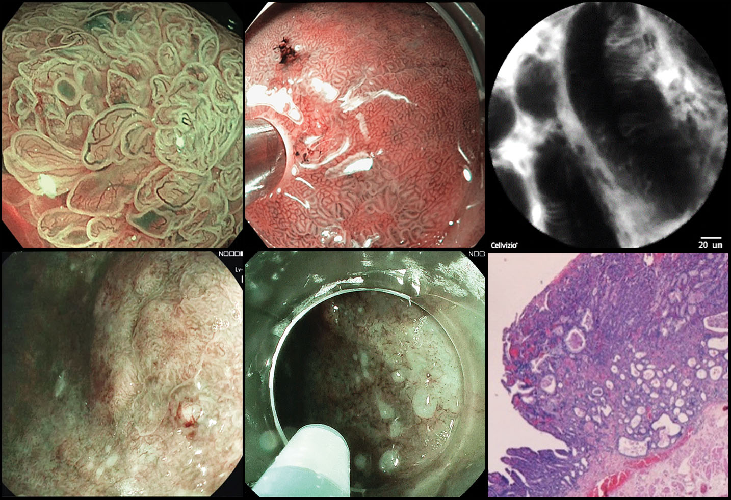 DU Endoscopie diagnostique avancée